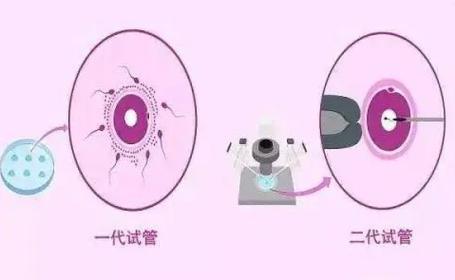 试管婴儿试管代怀可以吗-试管婴儿代怀孕是否可行？